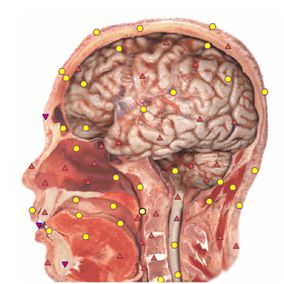 Aufnahme eines menschlichen Kopfes