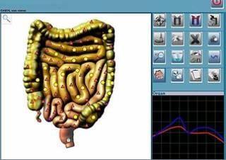 Darstellung Analyse und Untersuchung mit NLS Darm